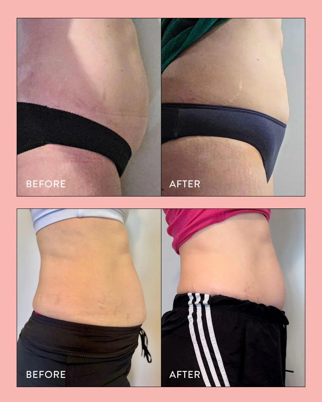 Super Gut - Image 3